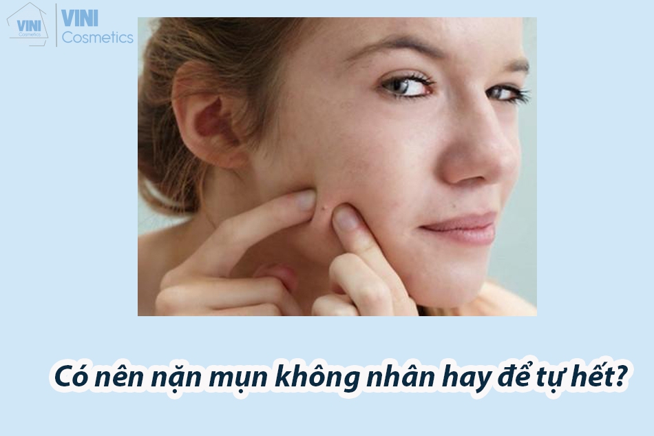 Có nên nặn mụn không nhân hay để tự hết?