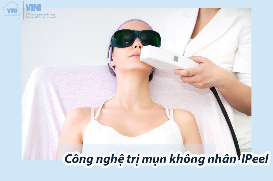 Công nghệ trị mụn IPeel