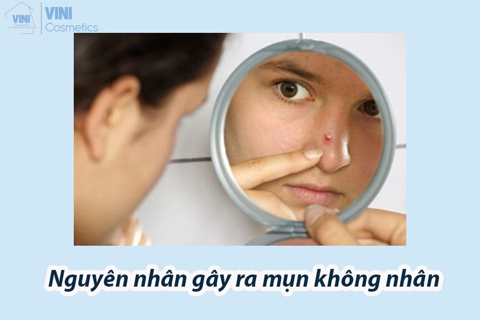 Nguyên nhân gây ra mụn không nhân