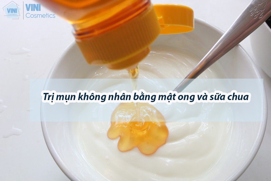 Trị mụn không nhân bằng mật ong và sữa chua